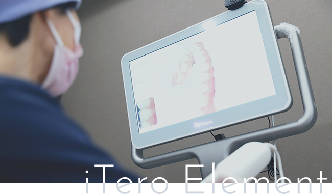 デジタル印象採取装置iTero（アイテロ）導入