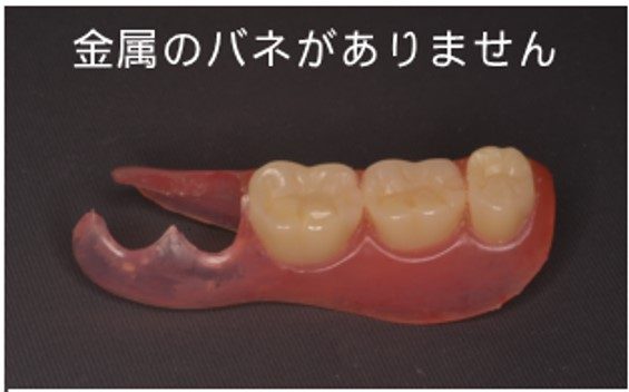 審美性重視型義歯（エステデンチャー）