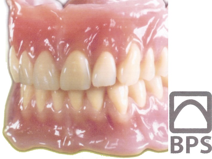 適合重視型義歯（BPSデンチャー